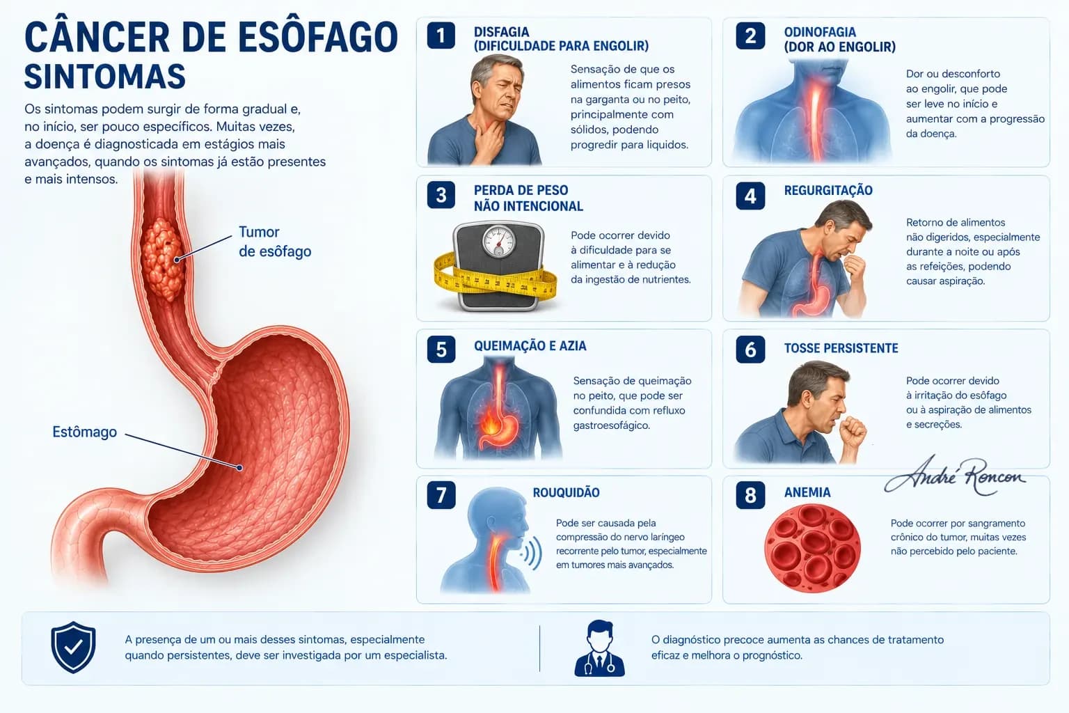 principais sintomas do câncer de esôfago: disfagia, odinofagia, perda de peso, regurgitação, azia, tosse, rouquidão e anemia