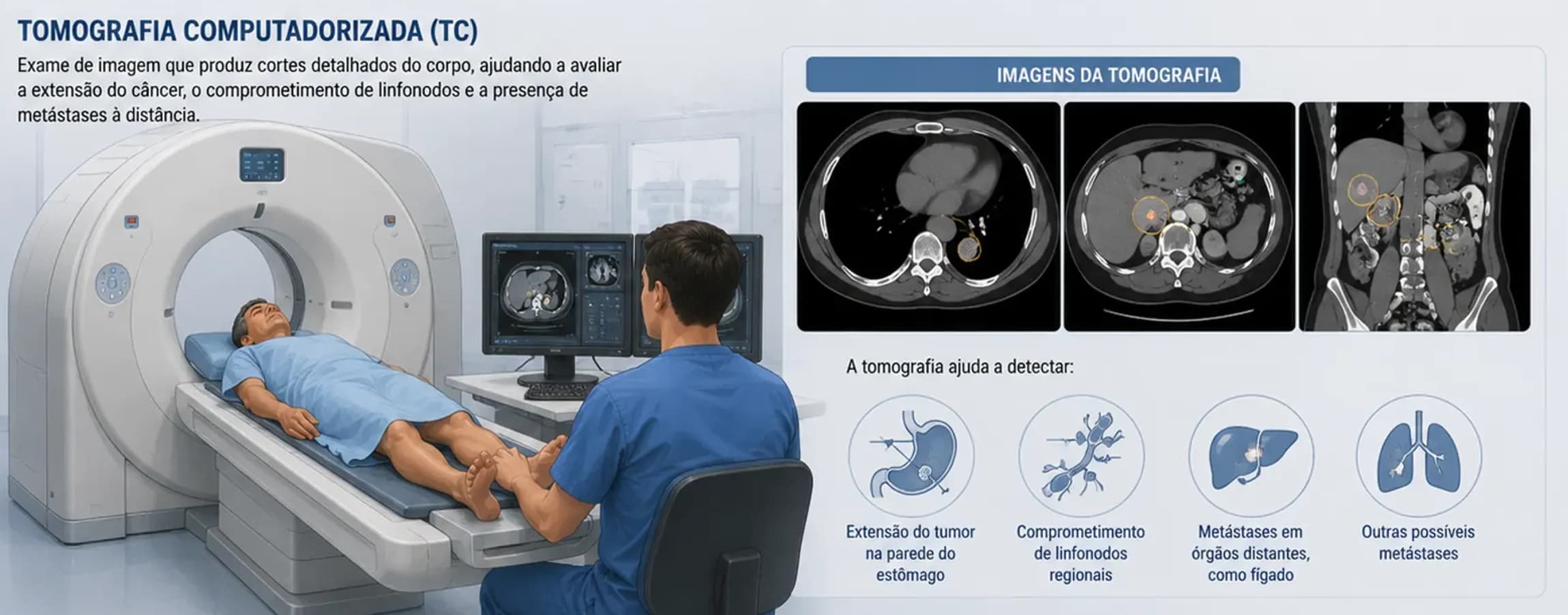 exames de estadiamento do câncer de estômago